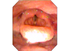 Oesophageal Screening for the Speech-Language Therapist image