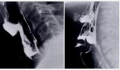 Radiation Training for Speech-Language Therapists image